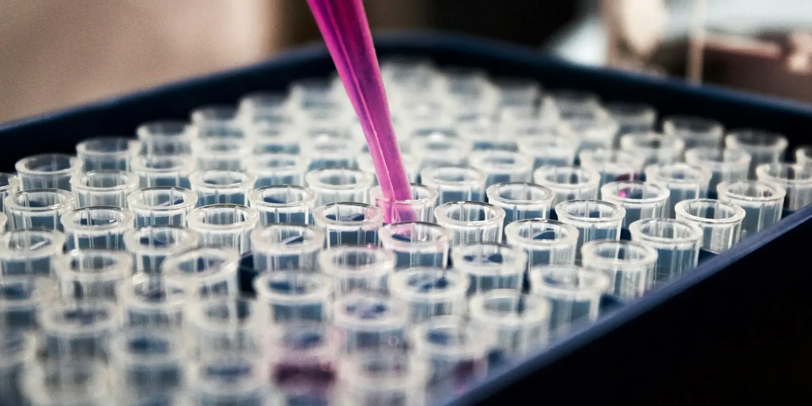 Samples being tested in a diagnostic laboratory, UK